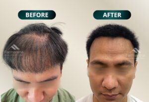 before-after2